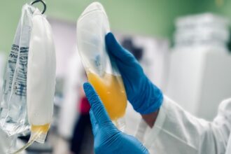 Πλασμαφαίρεση: Η ιατρική θεραπεία που έγινε μόδα του Χόλιγουντ