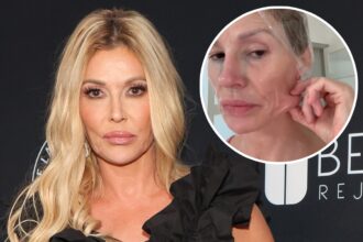 Brandi Glanville Getting Surgery to Find Out What's "Eating" Her Face